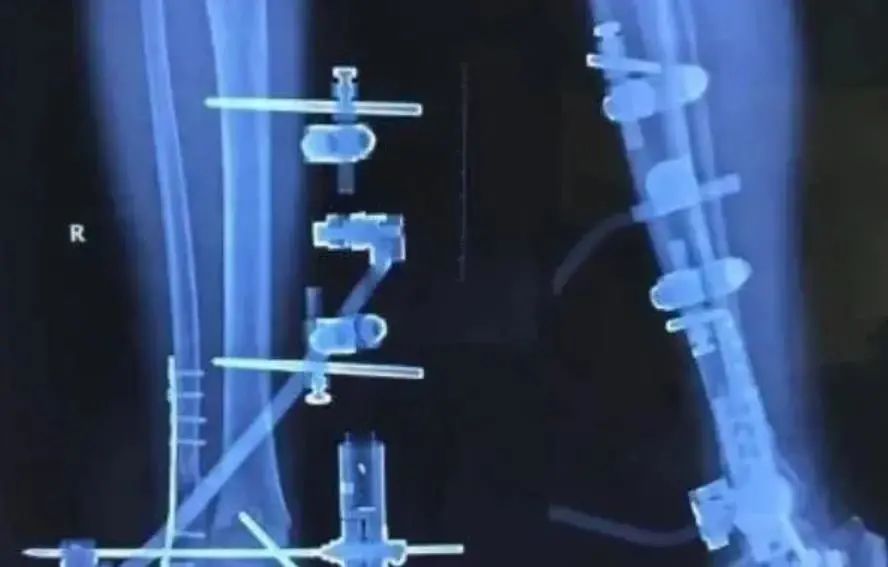 微信图片_20210329161941.jpg 微信图片_20210329161941.jpg